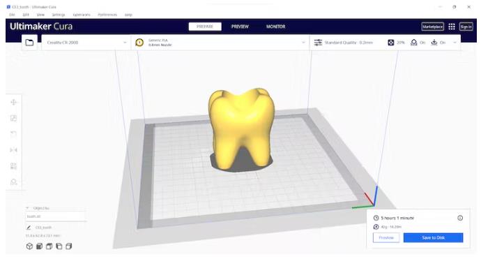 AI驱动的牙模分类器—基于Edge Impulse平台图5