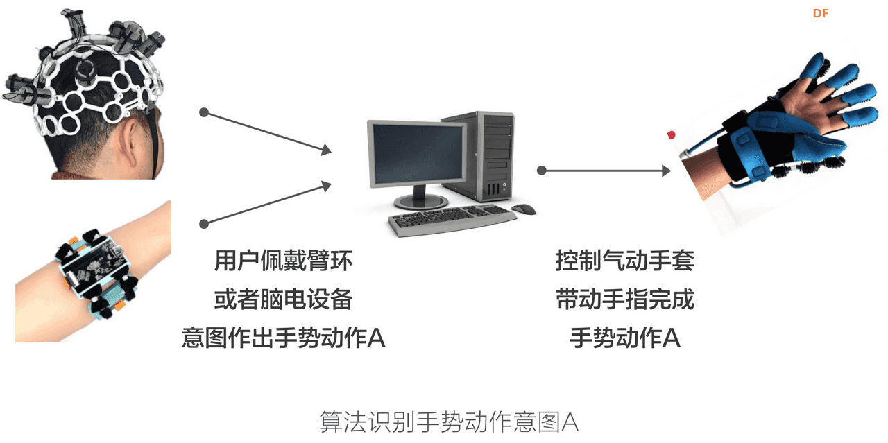 国产基于脑机接口的中风后主动康复训练解决方案图3