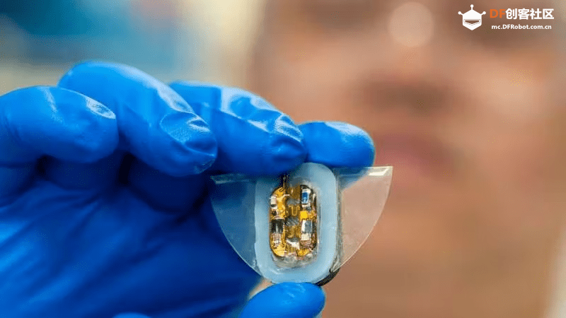 让软体机器人真正“脱绳”运行、智能牙套、防***智...图2